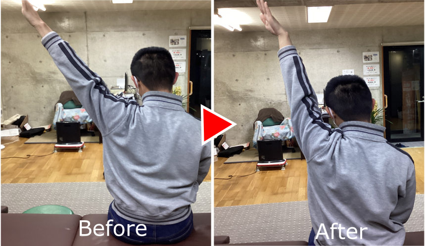 男性肩痛2 男性肩痛2